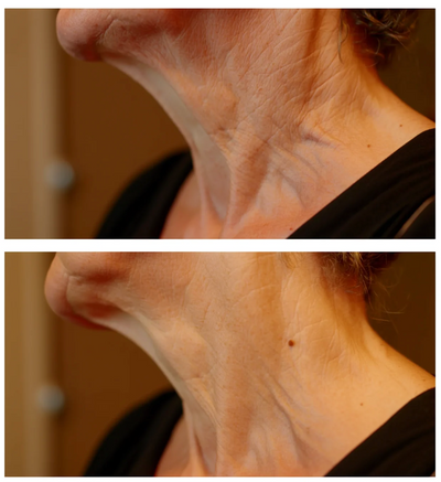 HerEra Copper Peptide Serum